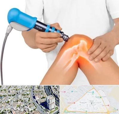 شاک ویو تراپی در قاسم آباد مشهد