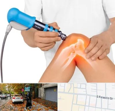 شاک ویو تراپی در خیابان فلسطین