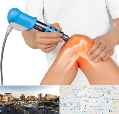 شاک ویو تراپی در منطقه 7 تهران