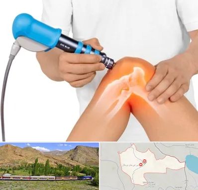 شاک ویو تراپی در خاش