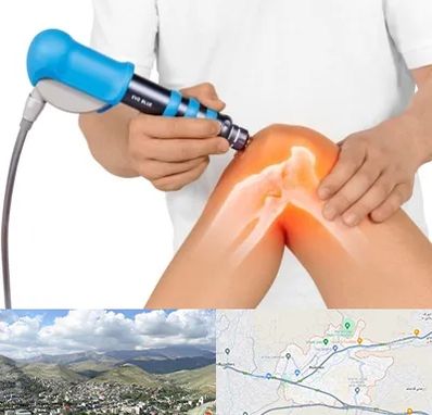 شاک ویو تراپی در رودهن