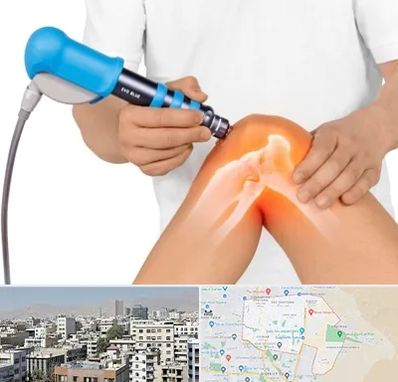 شاک ویو تراپی در منطقه 14 تهران