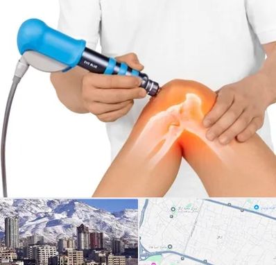 شاک ویو تراپی در ازگل