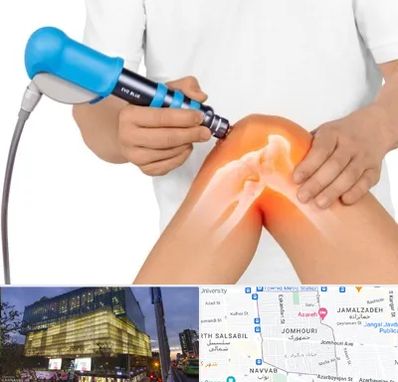 شاک ویو تراپی در جمهوری