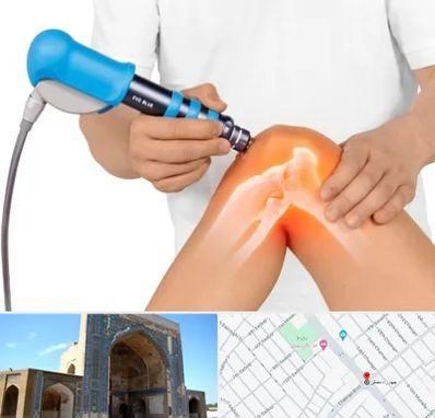 شاک ویو تراپی در مصلی مشهد