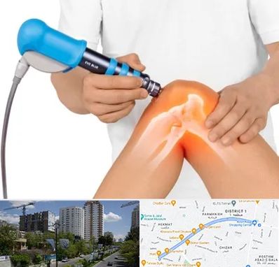 شاک ویو تراپی در اندرزگو