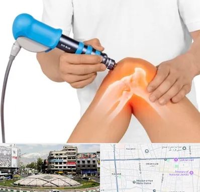 شاک ویو تراپی در مرکز تهران