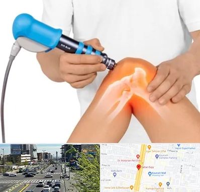 شاک ویو تراپی در ستاری