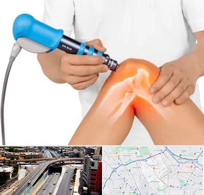 شاک ویو تراپی در ستارخان شیراز