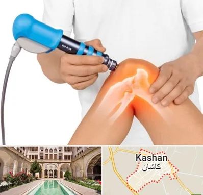 شاک ویو تراپی در کاشان