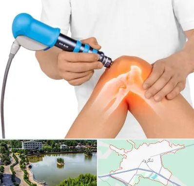 شاک ویو تراپی در لنگرود