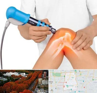 شاک ویو تراپی در منطقه 6 تهران