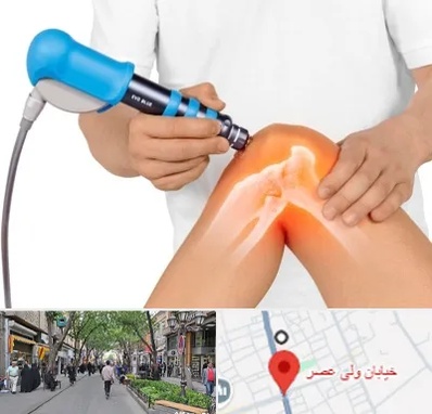 شاک ویو تراپی در ولیعصر شهریار