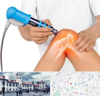 شاک ویو تراپی در میدان شهرداری رشت