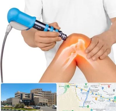 شاک ویو تراپی در صیاد شیرازی مشهد