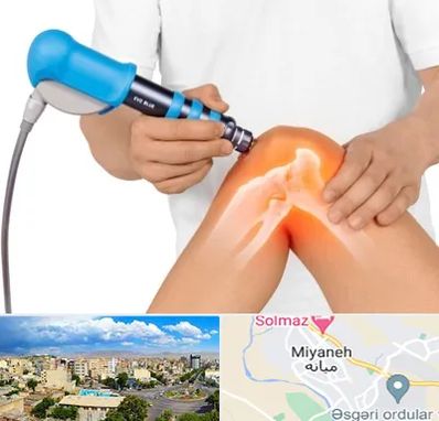 شاک ویو تراپی در میانه