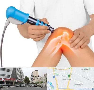 شاک ویو تراپی در بلوار فردوس