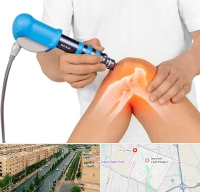 شاک ویو تراپی در فاز سه اندیشه