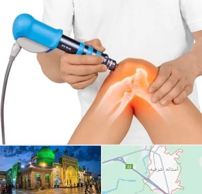 شاک ویو تراپی در آستانه اشرفیه