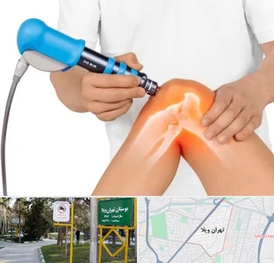 شاک ویو تراپی در تهران ویلا