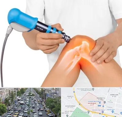 شاک ویو تراپی در گلشهر کرج