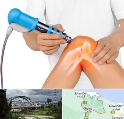 شاک ویو تراپی در چالوس