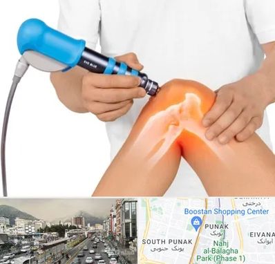 شاک ویو تراپی در پونک