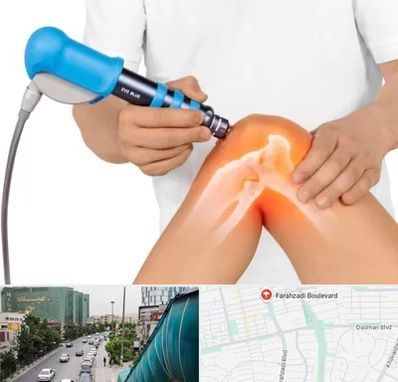 شاک ویو تراپی در بلوار فرحزادی