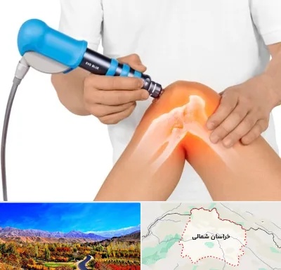 شاک ویو تراپی در خراسان شمالی