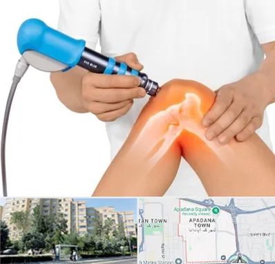 شاک ویو تراپی در آپادانا