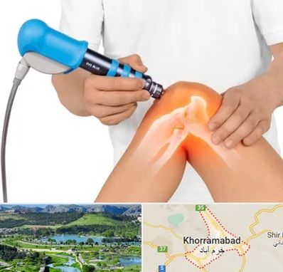 شاک ویو تراپی در خرم آباد