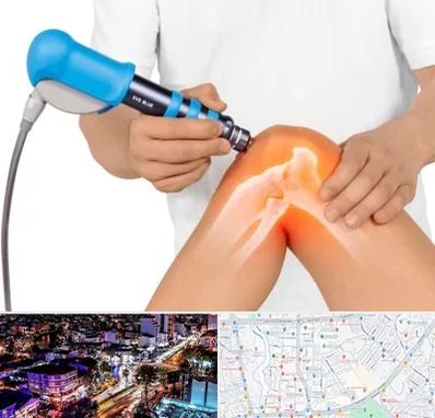 شاک ویو تراپی در منظریه رشت