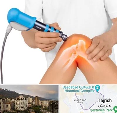 شاک ویو تراپی در زعفرانیه