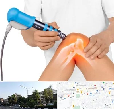 شاک ویو تراپی در میدان کاج