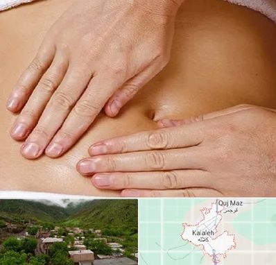 متخصص ناف گیری در کلاله