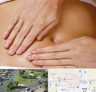 متخصص ناف گیری در شاهین ویلا کرج