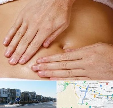 متخصص ناف گیری در شریعتی مشهد