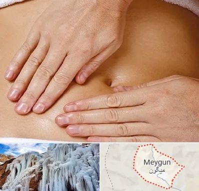 متخصص ناف گیری در میگون