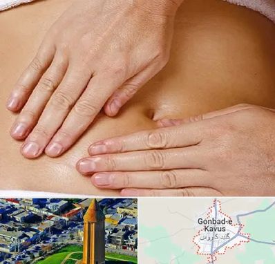 متخصص ناف گیری در گنبد کاووس