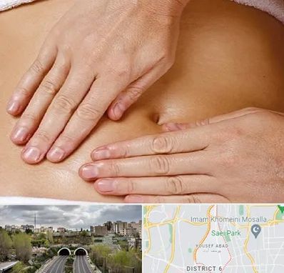 متخصص ناف گیری در یوسف آباد