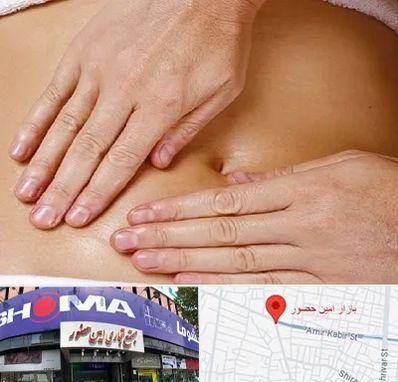 متخصص ناف گیری در امین حضور