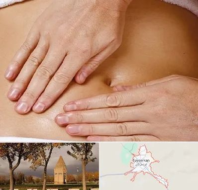 متخصص ناف گیری در تویسرکان