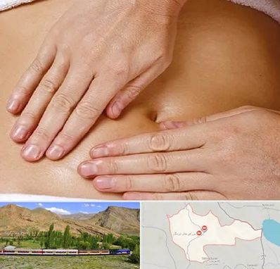 متخصص ناف گیری در خاش