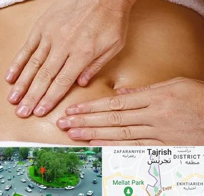 متخصص ناف گیری در تجریش