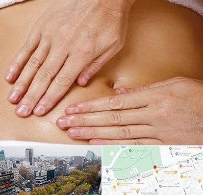 متخصص ناف گیری در بلوار کشاورز