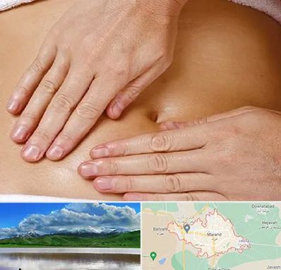 متخصص ناف گیری در مرند