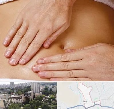 متخصص ناف گیری در اوین