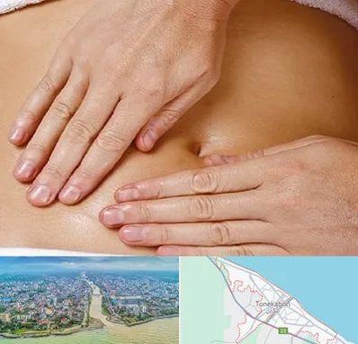 متخصص ناف گیری در تنکابن