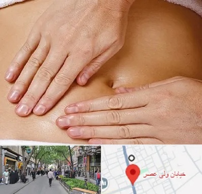 متخصص ناف گیری در ولیعصر شهریار