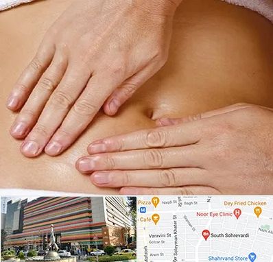 متخصص ناف گیری در سهروردی